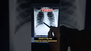 how to read chest xray  radiology  viral youtubeshorts radiology anatomy shorts biology [upl. by Llewen]