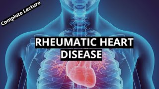 Rheumatic Heart Disease [upl. by Shiau]