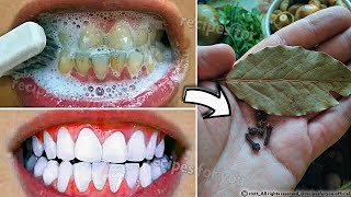 Secret that Dentists dont want you to know Remove Tartar and Teeth Whitening in just 2 minutes [upl. by Lindi]