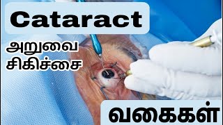 Cataract அறுவை சிகிச்சை வகைகள்  Every type explained clearly  Ophthalmology  MBBS [upl. by Silma]