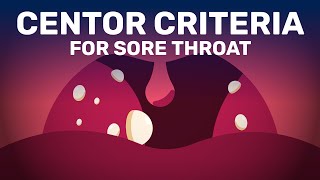 Is Your Sore Throat Caused by Bacterial Infection or Viral [upl. by Heddy505]