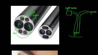 How Does an Endoscope Work  GCSE Physics [upl. by Aicelf]