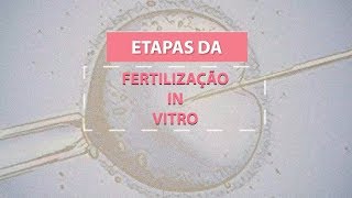 Etapas da fertilização in vitro [upl. by Jamesy357]