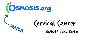 Cervical Cancer Osmosis Study Video [upl. by Beore]