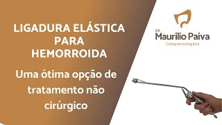 Ligadura elástica para hemorroida Uma ótima opção de tratamento não cirúrgico [upl. by Mcspadden]