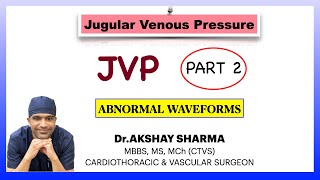 JUGULAR VENOUS PRESSURE JVP PART 2 ABNORMAL WAVEFORM  for NEETPG USMLE FMGE [upl. by Baram]