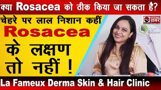 चेहरे पर Rosacea यानी लाल चकत्तों से बचना है  Dermatologist से जानिए क्या करें  La Fameux Derma [upl. by Emelen]