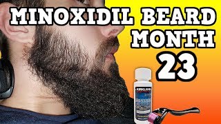 Minoxidil Beard Growth Results  Month 23  TheJourneyContinues [upl. by Nrubyar]