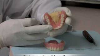 How to perform Denture Repairs  Huntington Beach and Corona [upl. by Ocire]