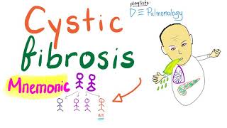 Cystic Fibrosis  Mnemonic [upl. by Hertz]