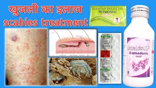 Gamaderm Lotion 🧴 Uses in Hindi खुजली का इलाज Scabies Treatment in Hindi [upl. by Naxor]