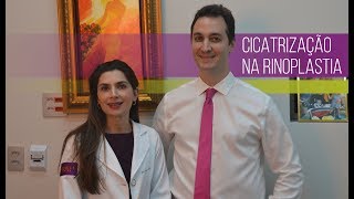 Fibrose Supra tip e Cicatrização na Rinoplastia [upl. by Lonni]