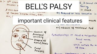 Bells Palsy Explained In Hindi [upl. by Mauceri]