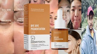 Dermatouch Bye Bye Pigmentation Serum  Honest Review [upl. by Berlauda]