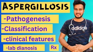 Aspergillosis microbiologymorphologypathogenesislabdiagnosisTreatment [upl. by Atlee]