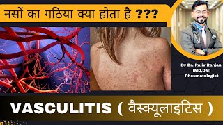 नसों का गठिया । Vasculitis Diseases  वैस्क्यूलाइटिस के बारे में जाने [upl. by Luar]