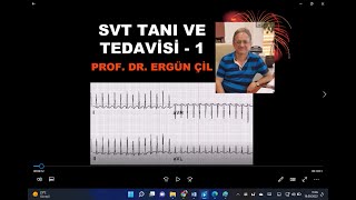 EKG 11 SUPRAVENTRİKÜLER TAŞİKARDİ TANI VE TEDAVİ – 1 [upl. by Annoet]