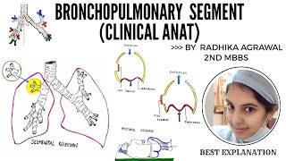 Bronchopulmonary Segment Introduction and Clinical Anatomy  MedSeed MBBS [upl. by Kelli563]