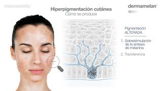 Dermamelan Guía de Uso Español [upl. by Alit]