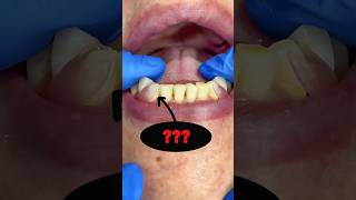 DID YOU KNOW that flexible dental prostheses exist music amongus beats animation art mrdent [upl. by Okemak]