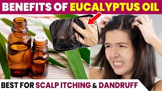 How to use Eucalyptus Oil  Eucalyptus Oil for Hair Growth [upl. by Neira]