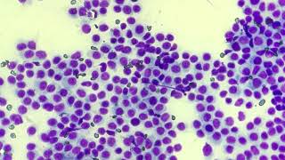 Histiocytoma cytology [upl. by Kilgore]