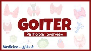 Goiter non neoplastic thyroid enlargement  pathology overview شرح عربي [upl. by Higinbotham]