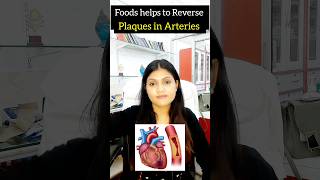 foods to help Reverse Plaques in artery  cholesterol control shorts cholesterol [upl. by Amehsyt480]