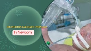 BRONCHOPULMONARY DYSPLASIA CHRONIC LUNG DISEASE  DEFINATION DR MEENA CHOUDHARY [upl. by Ruskin]