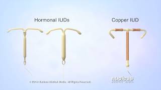 What is an IUD [upl. by Nywde]