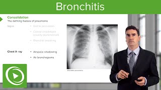 Bronchitis Consequences Symptoms amp Treatment – Respiratory Medicine  Lecturio [upl. by Teodoor]