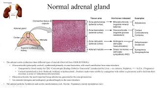 Pathology Made EasySystemic Pathology 11Endocrine glands Diseases4Adrenal gland Diseases1 [upl. by Dorfman]