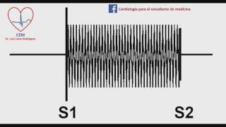 Soplo de la insuficiencia tricuspideamurmur of tricupsid regurgitation [upl. by Sherlocke]