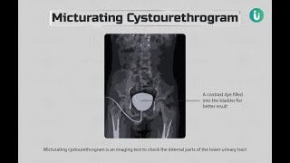 Anterograde Urethrography Xray  Micturating CystoUrethrogram Xray [upl. by Ariak529]