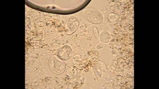 Mixed Ciliates from Hay Infusion [upl. by Jan]