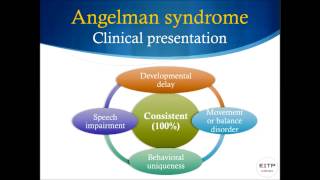 Prader Willi and Angelman Syndromes CLinical Features and Developmental Outcomes [upl. by Lexa310]