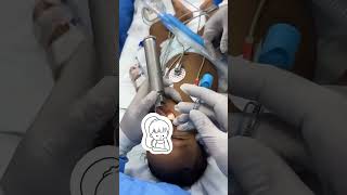 inserting a tube into a patients windpipe to secure their airway and provide oxygen [upl. by Cha]