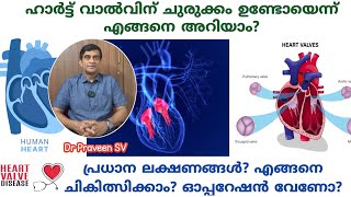 ഹാർട്ട്‌ വാൽവിന്റെ ചുരുക്കംHeart valve disease malayalamAortic stenosis malayalamMitral stenosis [upl. by Eiuqcaj]