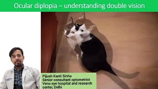 Ocular diplopia  understanding double vision [upl. by Harbison]