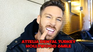 HOLLYWOOD SMILE  ATTELIA DENTAL TURKEY [upl. by Ailime]