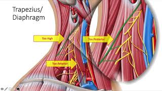 PEARLS IN PLEXUS AND FASCIAL PLANE BLOCKS [upl. by Adnah108]