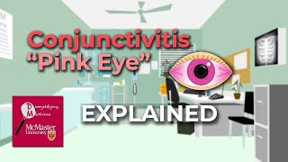 Conjunctivitis Pink Eye Explained [upl. by Liggitt829]