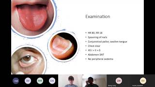 Anaemia and Haemolysis [upl. by Annoirb]