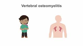 How to treat osteomyelitis [upl. by Cinomod]