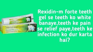 Rexidinm forte teeth gel review [upl. by Eugilegna]