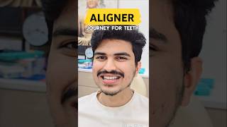 aligners for teethinvisalign bracescrowdingteeth smile trending viralvideo dental shorts [upl. by Netsrek]