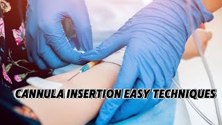 Intravenous IV Cannulation techniques subscribe cannulainsertion [upl. by Sjoberg]