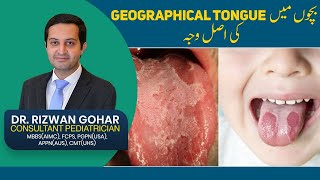 Treatment of Geographic Tongue👅😛 geographic tongue treatment [upl. by Turley]