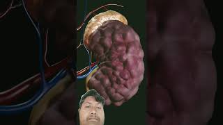 Polycystic kidney disease  anatomy short viral video kidneycyst [upl. by Alleon]