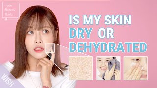 You Have Dry Skin amp ACNE Best Skincare for Dry vs Dehydrated Skin l You Need to See This [upl. by Opal]